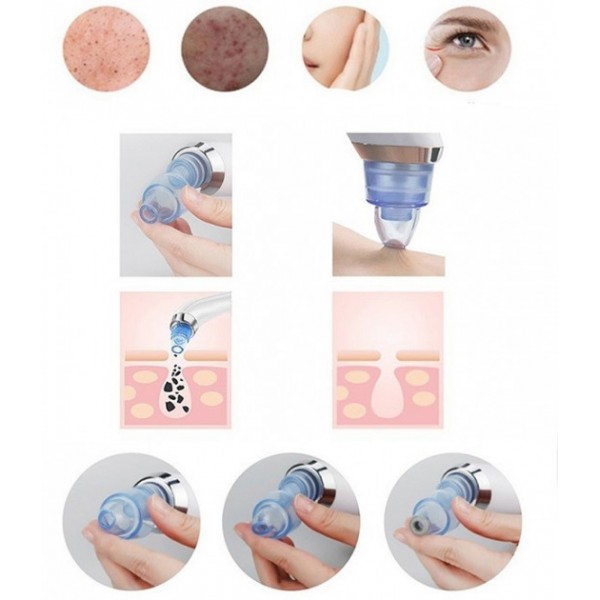 Вакуумний апарат для чищення пор ∙ Апаратна чистка обличчя Derma Suction - мініатюра 2