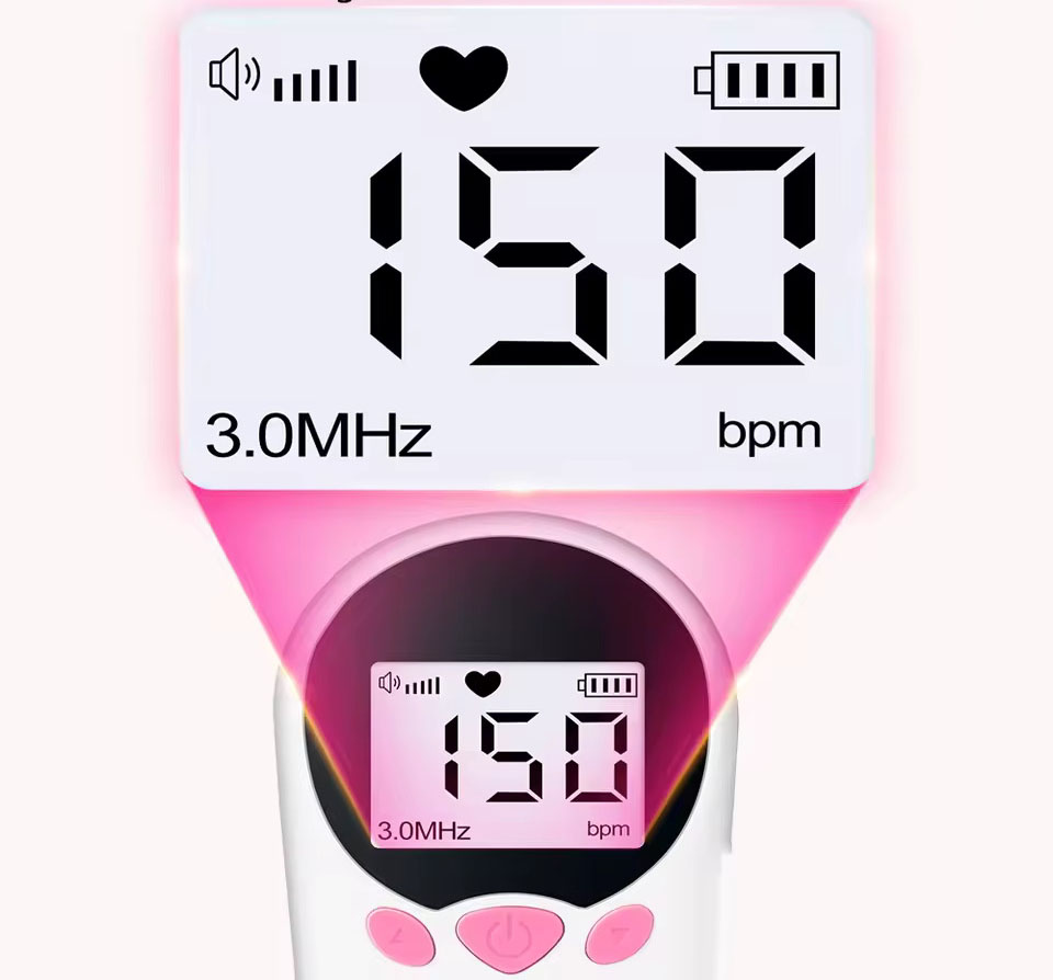 Фетальний допплер 3,0 МГц XL-1311 - мініатюра 3