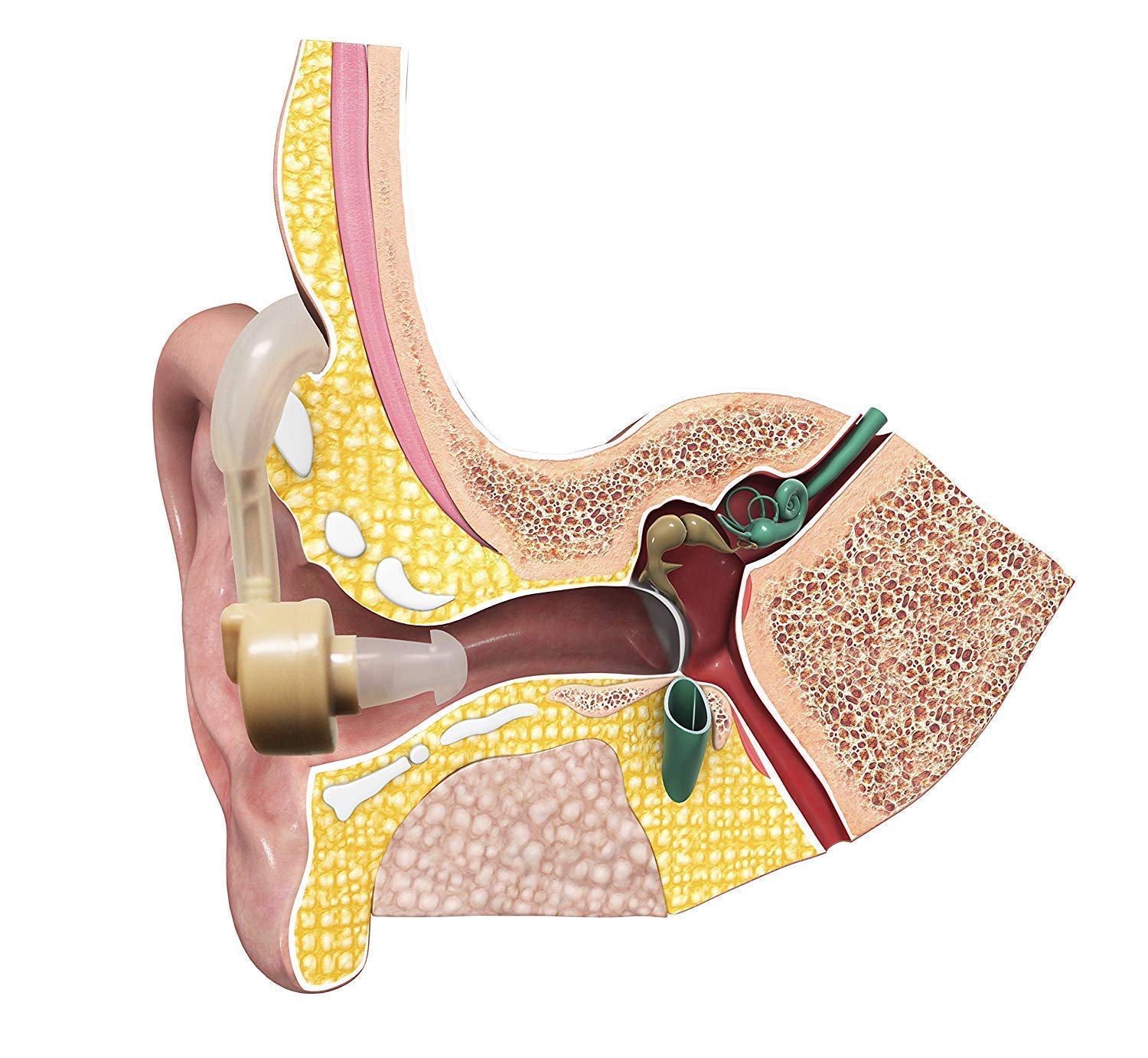 Завушний слуховий апарат Xingma XM-909E з трьома вкладишами - мініатюра 9