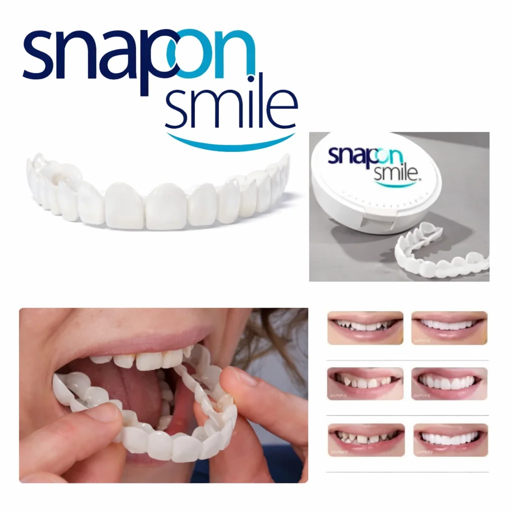 Знімні вініри Snap On Smile на 2 щелепи для швидкого візуального ефекту усмішки - мініатюра 1