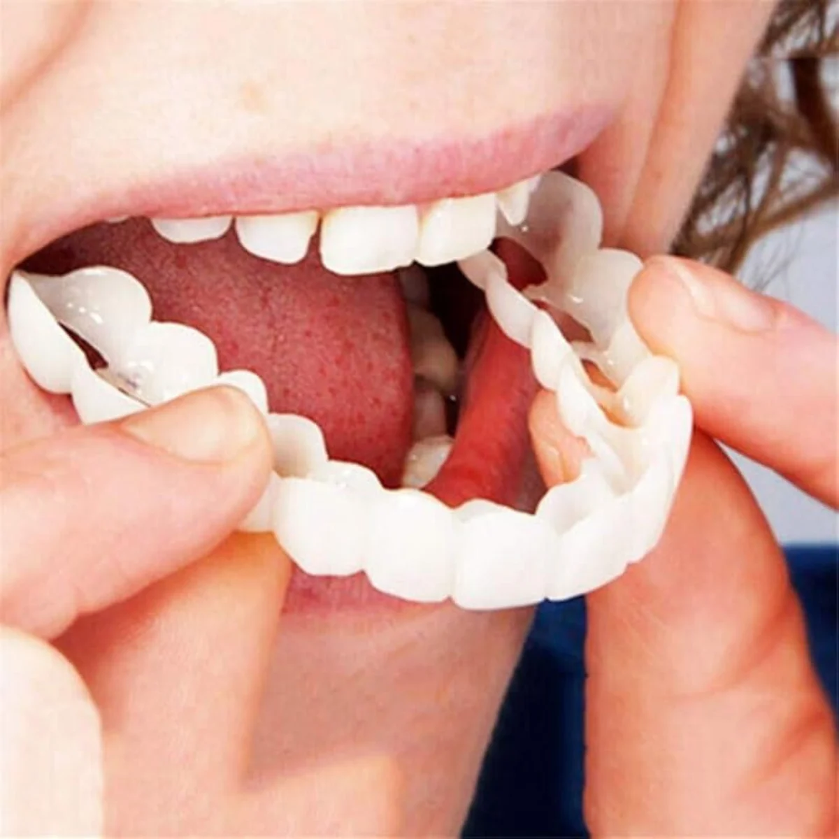 Знімні вініри Snap On Smile на 2 щелепи для швидкого візуального ефекту усмішки - мініатюра 5