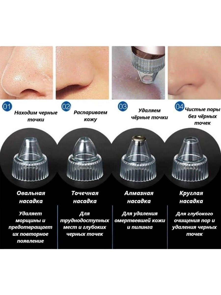Апарат для вакуумного чищення пор обличчя Plymex XN-8030 від чорних точок та вугрів - мініатюра 2